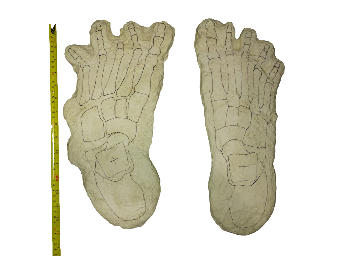 1969 Bigfoot Cripple Foot cast B