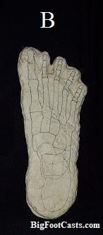 1969 Bigfoot Cripple Foot cast B