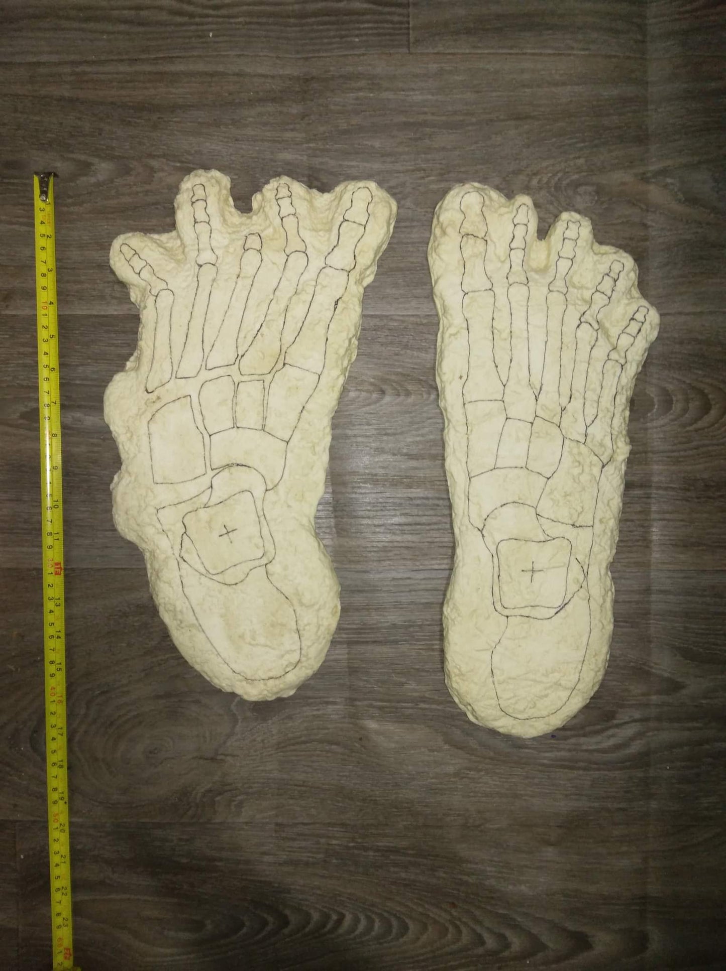 1969 Bigfoot Cripple Foot cast A