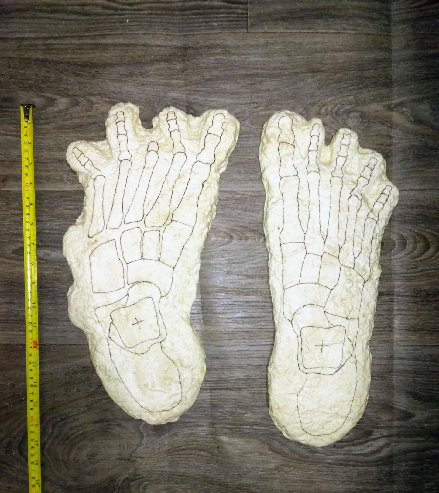 1969 Bigfoot Cripple Foot cast A