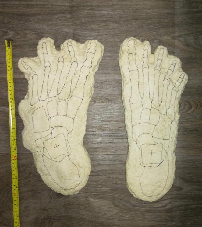 1969 Bigfoot Cripple Foot cast A